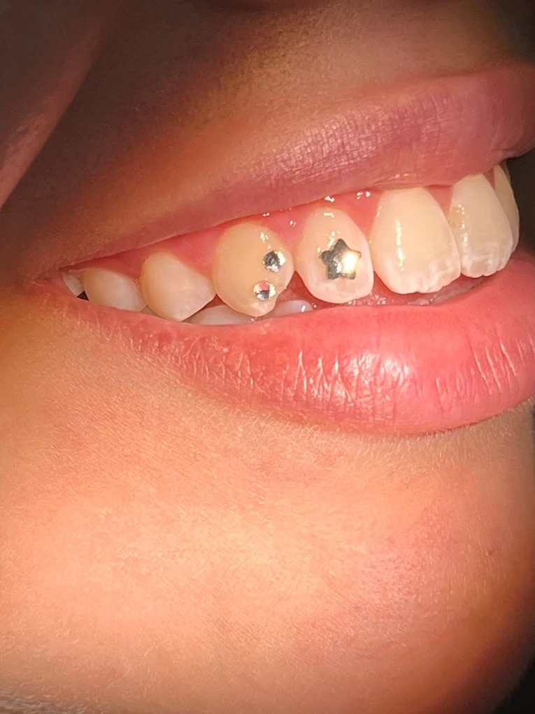 Joias e piercings dentais